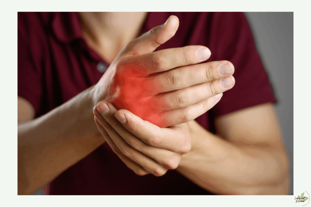 Typische Symptome einer Arthritis in der Hand Entzündetes Handgelenk mit Schwellung und Schmerzen als typisches Symptom einer Arthritis