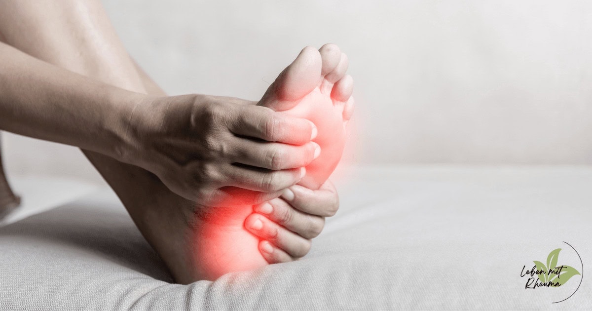 Fußschmerzen bei Rheuma und Rheumaschub Schmerzen und Entzündung im Fuß während eines Rheumaschub. Frau hält ihren schmerzenden Fuß während eines Rheumaschubs