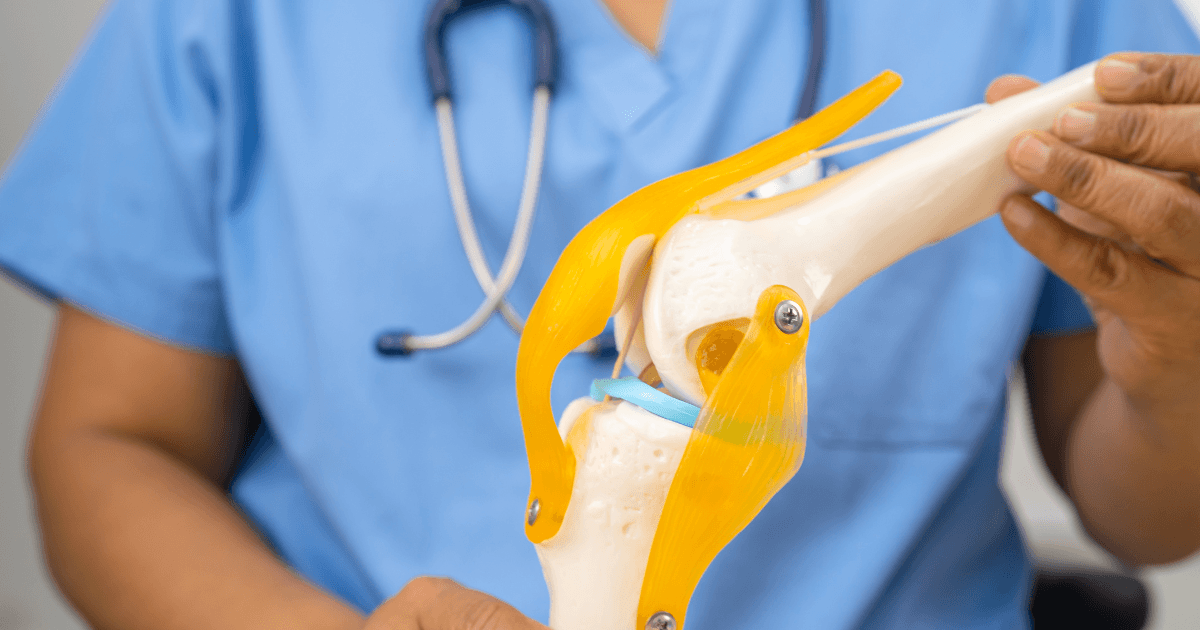 Arzt erklärt ein Kniegelenkmodell zur Diagnose von Arthritis und Arthrose