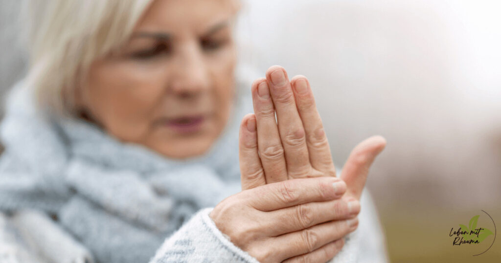 Frau betrachtet schmerzende und geschwollene Finger bei Psoriasis-Arthritis
